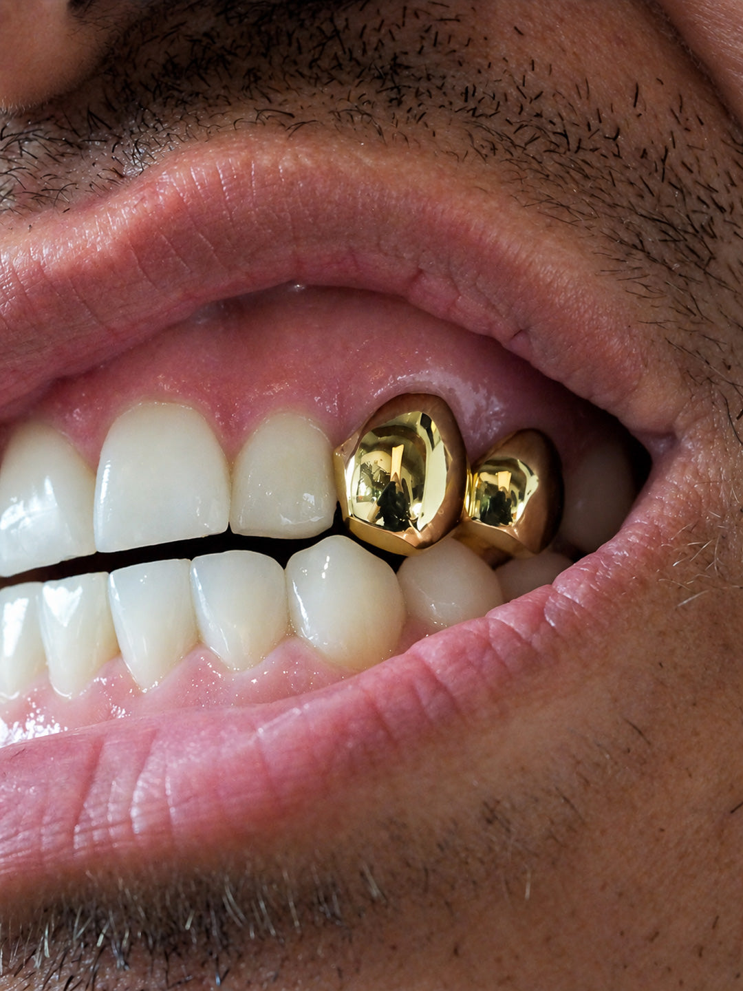 Two tooth classic gold grillz worn on the upper teeth, polished yellow gold caps