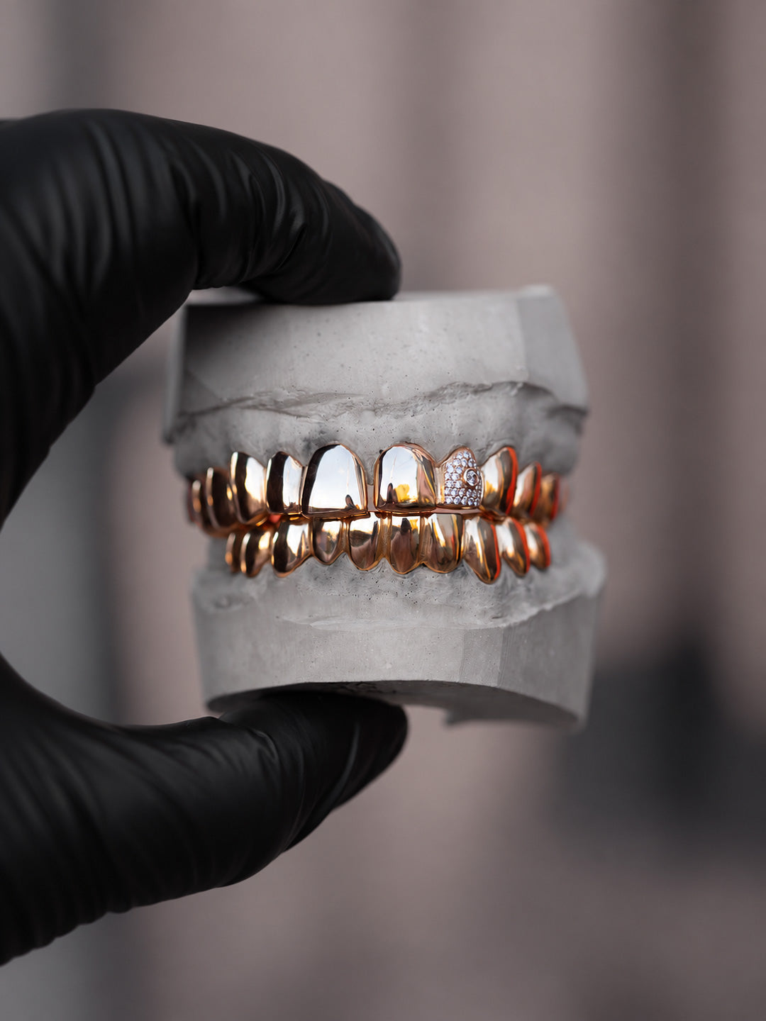 Full set gold grillz in 18k yellow gold with a custom pavé diamond tooth and centre stone, bespoke by Illoom Sydney