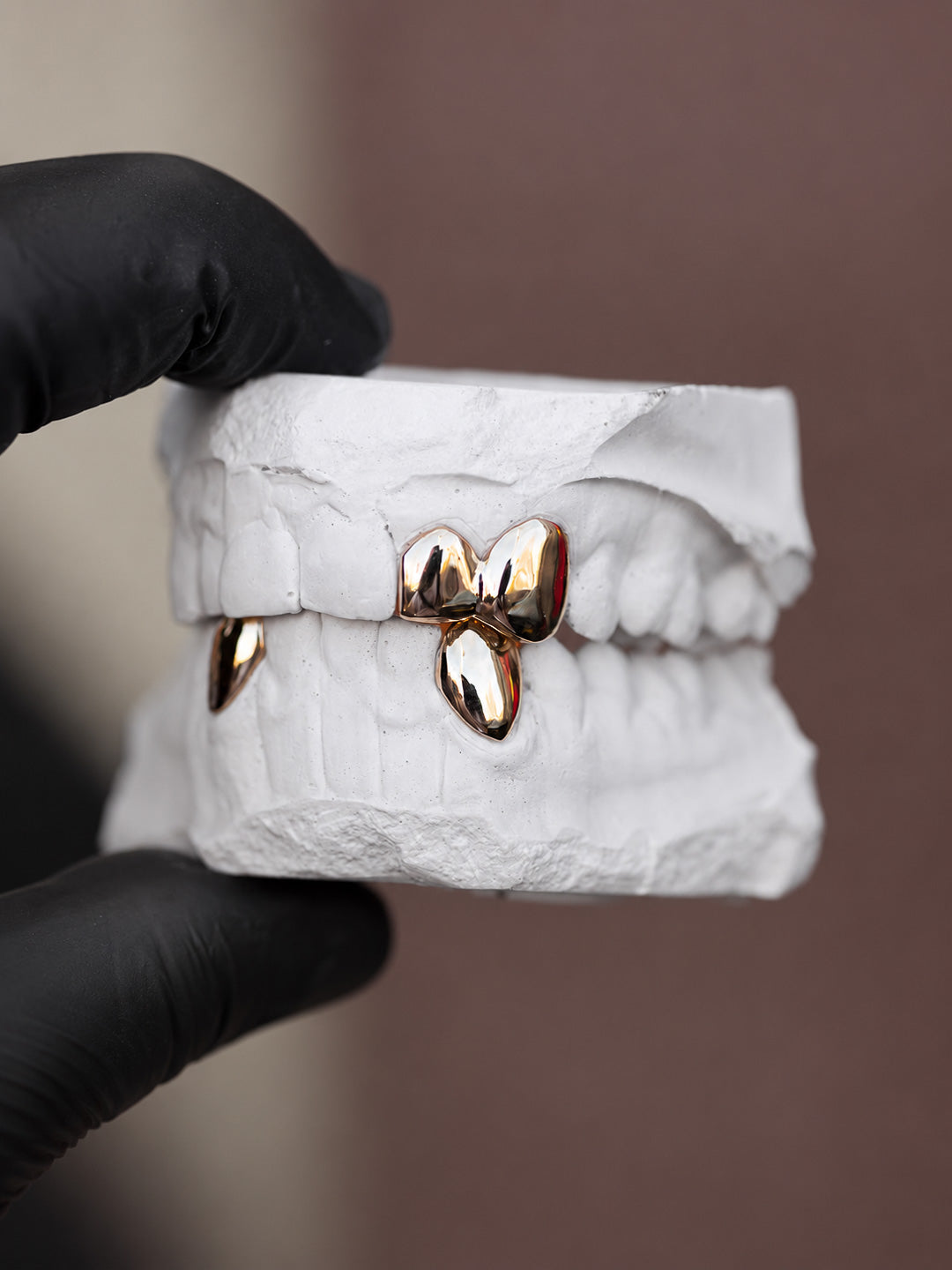 Classic grillz in 9k yellow gold, two top teeth and two single bottom teeth on dental mould