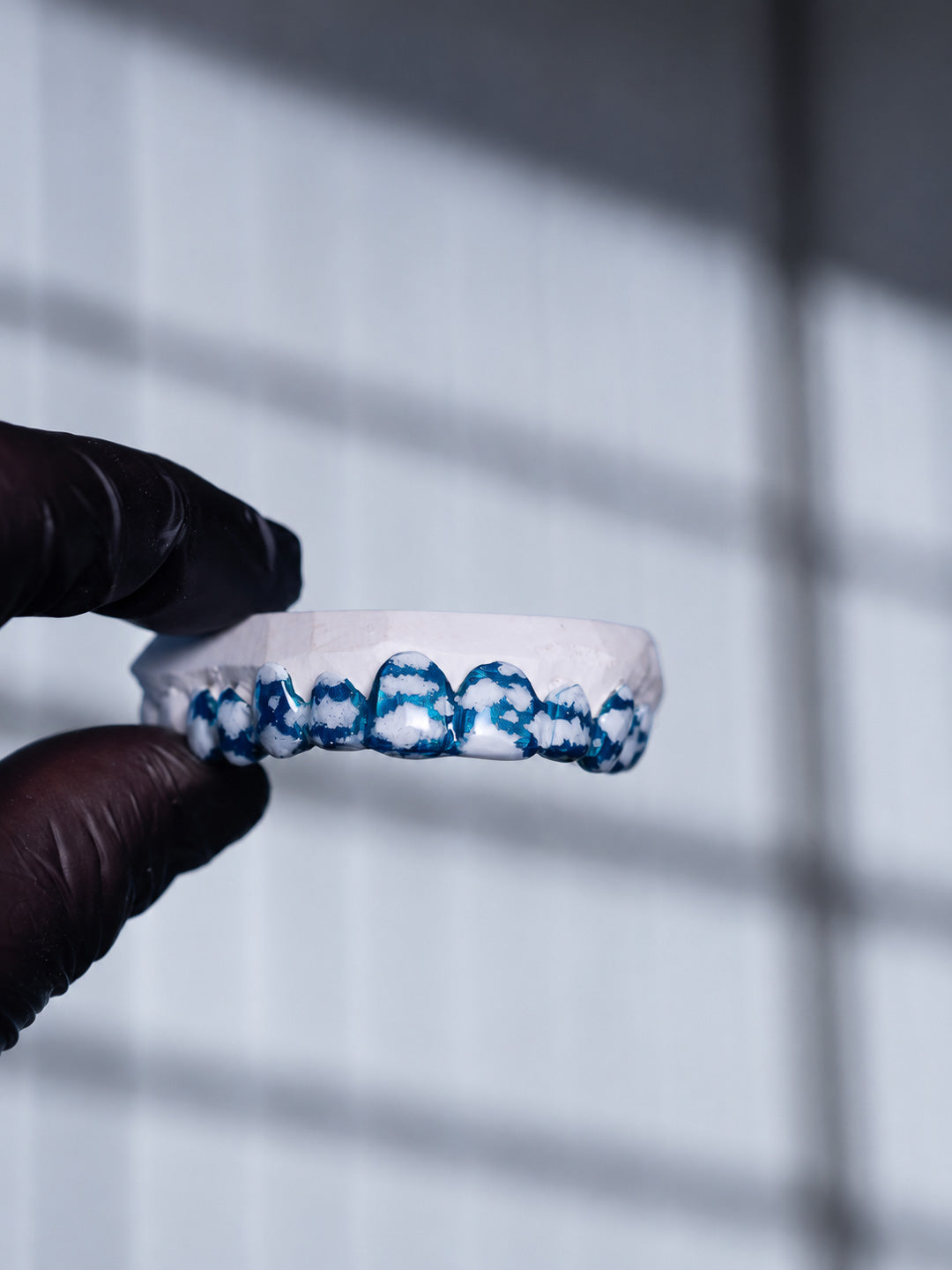 Cloud pattern enamel grillz across the top row, custom blue and white enamel design on dental mould