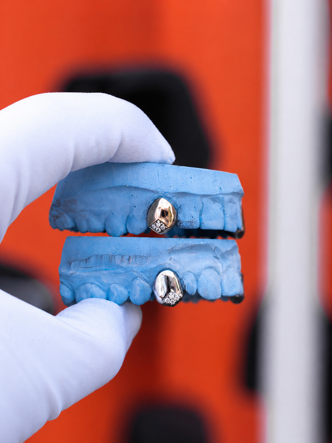 Cluster set diamond tip grillz on top and bottom moulds, a 9k yellow gold grill paired with a white gold grill