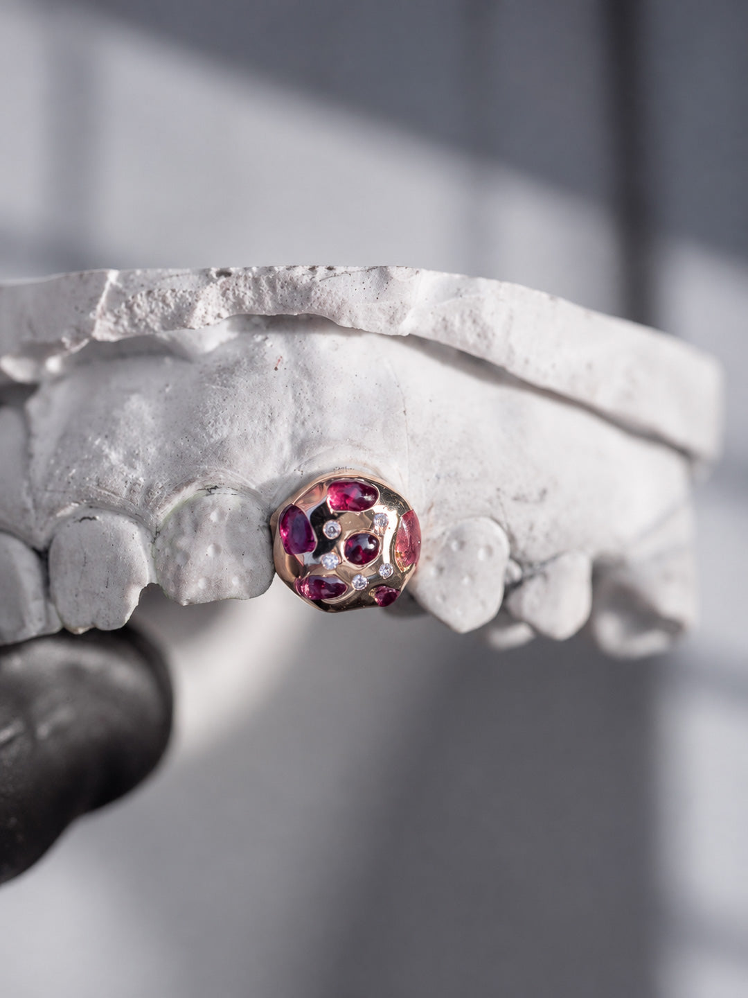 Custom grillz in yellow gold set with diamonds, pink sapphires and semi precious coloured stones