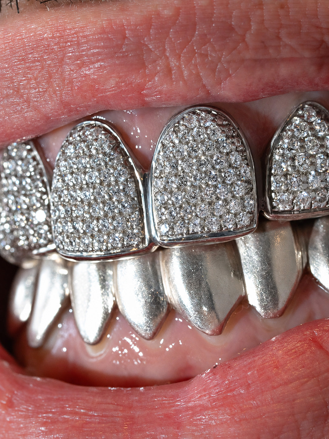 Silver teeth grillz worn as a top six pavé diamond set with a bottom eight classic set, bespoke by Illoom Sydney