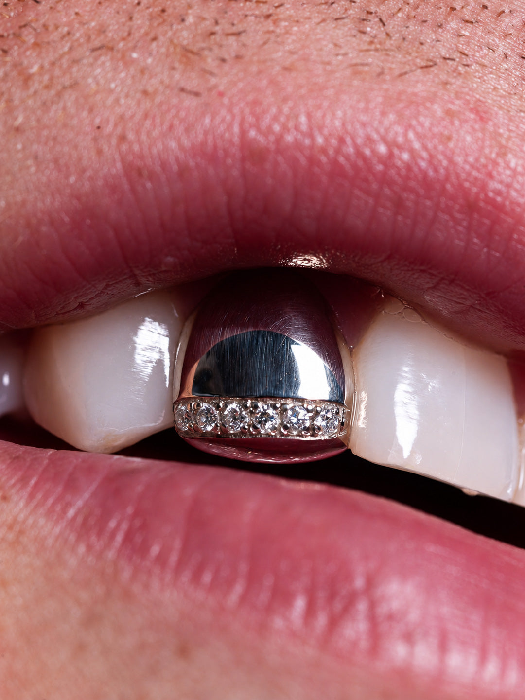 Diamond tip grillz worn on a single upper tooth, white gold with a pavé diamond row, bespoke by Illoom Sydney