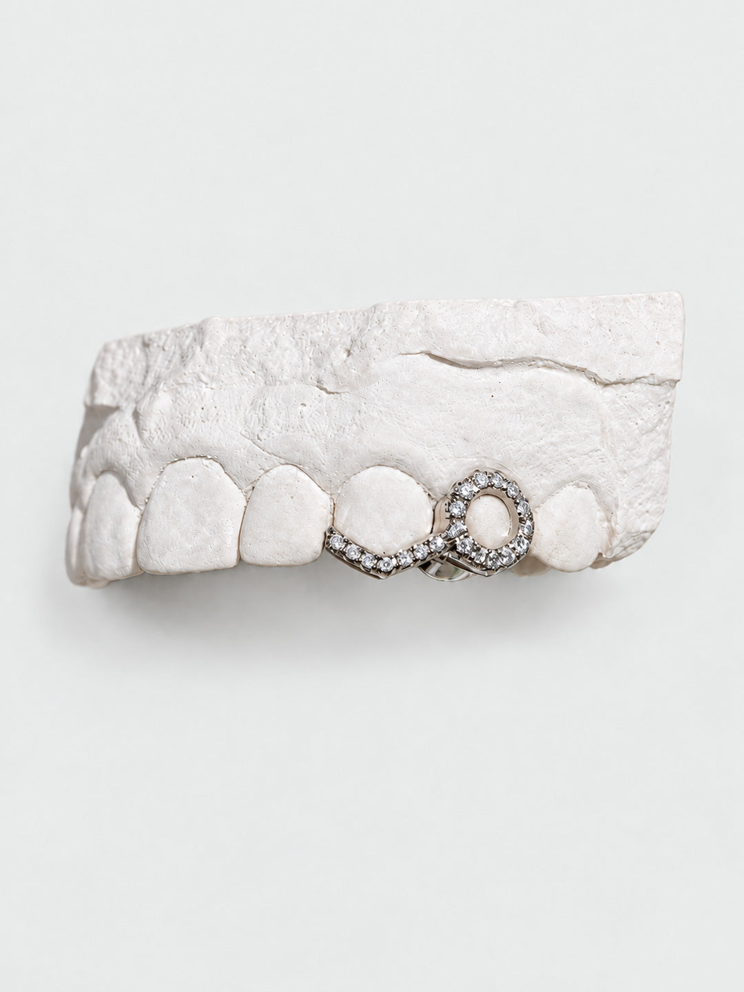 Diamond window grillz in 18k yellow gold with white diamonds, held on dental mould, bespoke by Illoom Sydney