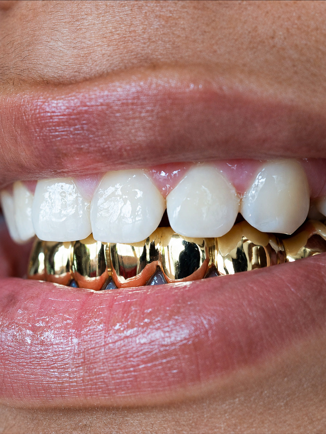 Gold teeth grillz worn as a full bottom set, classic polished style, bespoke by Illoom Sydney