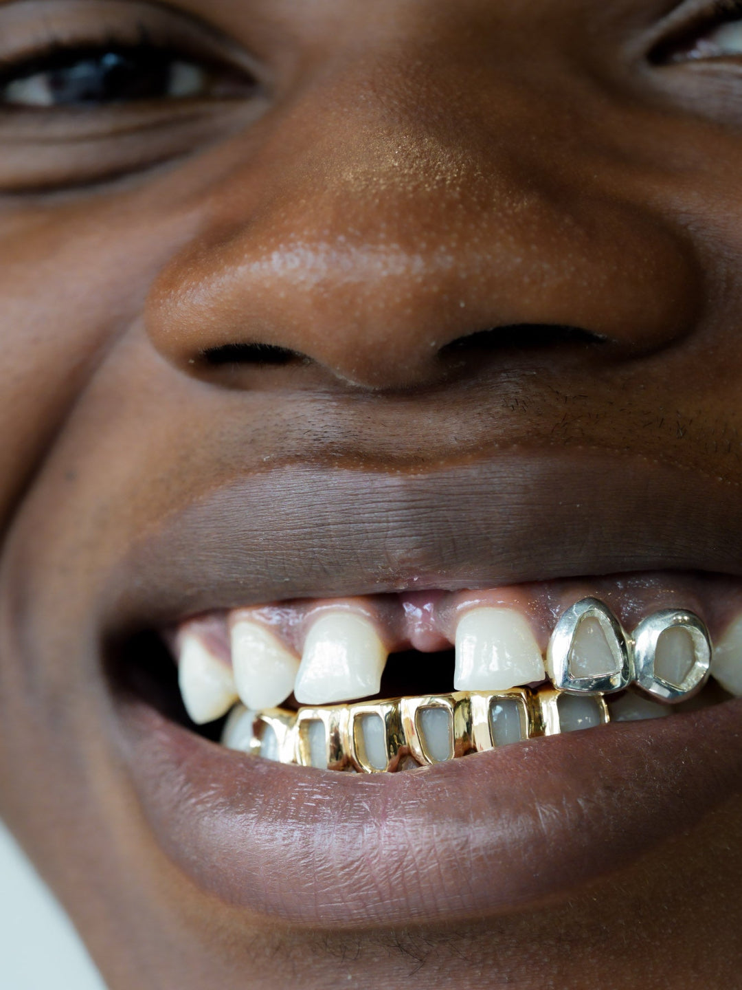 Gold teeth grillz worn across the bottom six teeth, open face window style in yellow gold, bespoke by Illoom Sydney