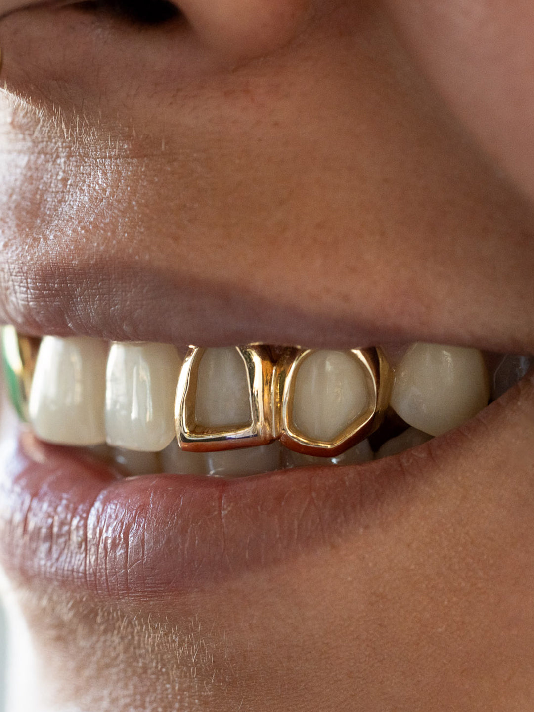 Window grillz in 18k yellow gold worn on the top teeth, open face style, side profile view