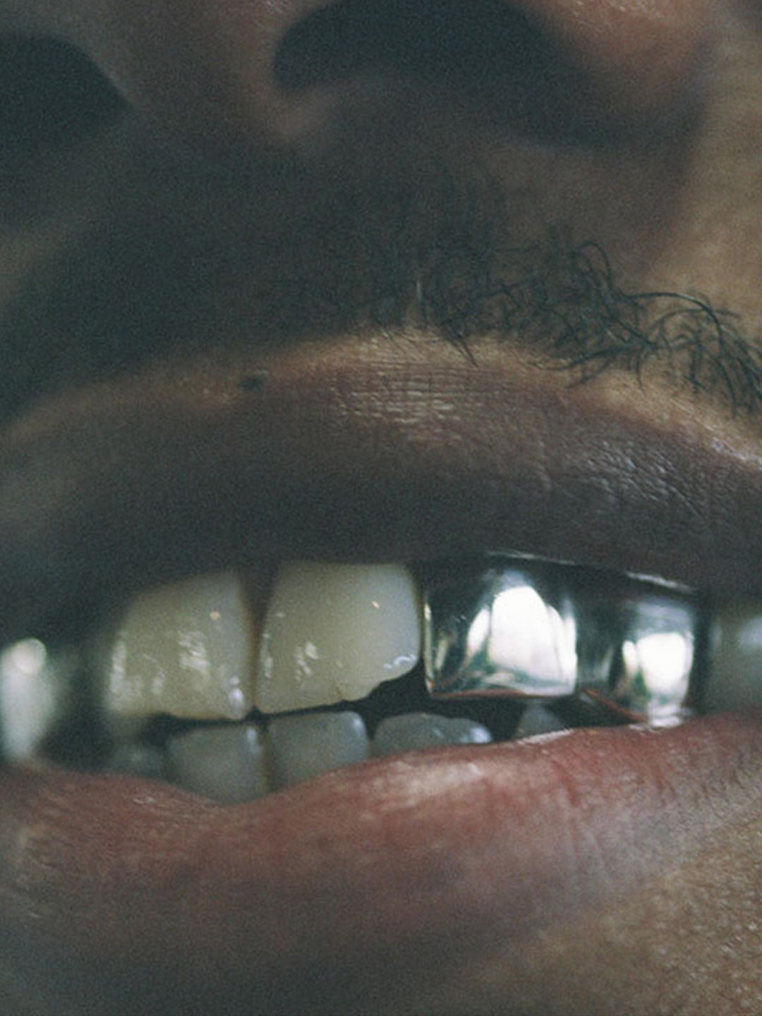 Silver teeth grillz worn on two upper teeth, classic polished style, bespoke by Illoom Sydney