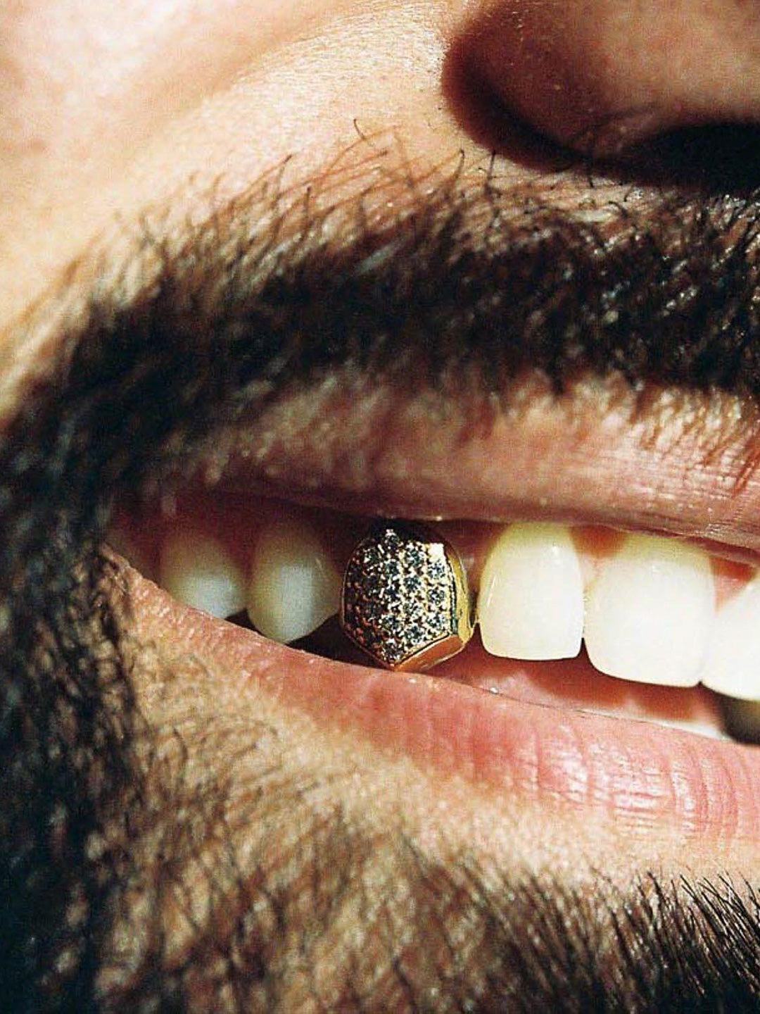 Single tooth grillz in 18k yellow gold, pavé VVS diamonds worn on the upper tooth, bespoke by Illoom Sydney