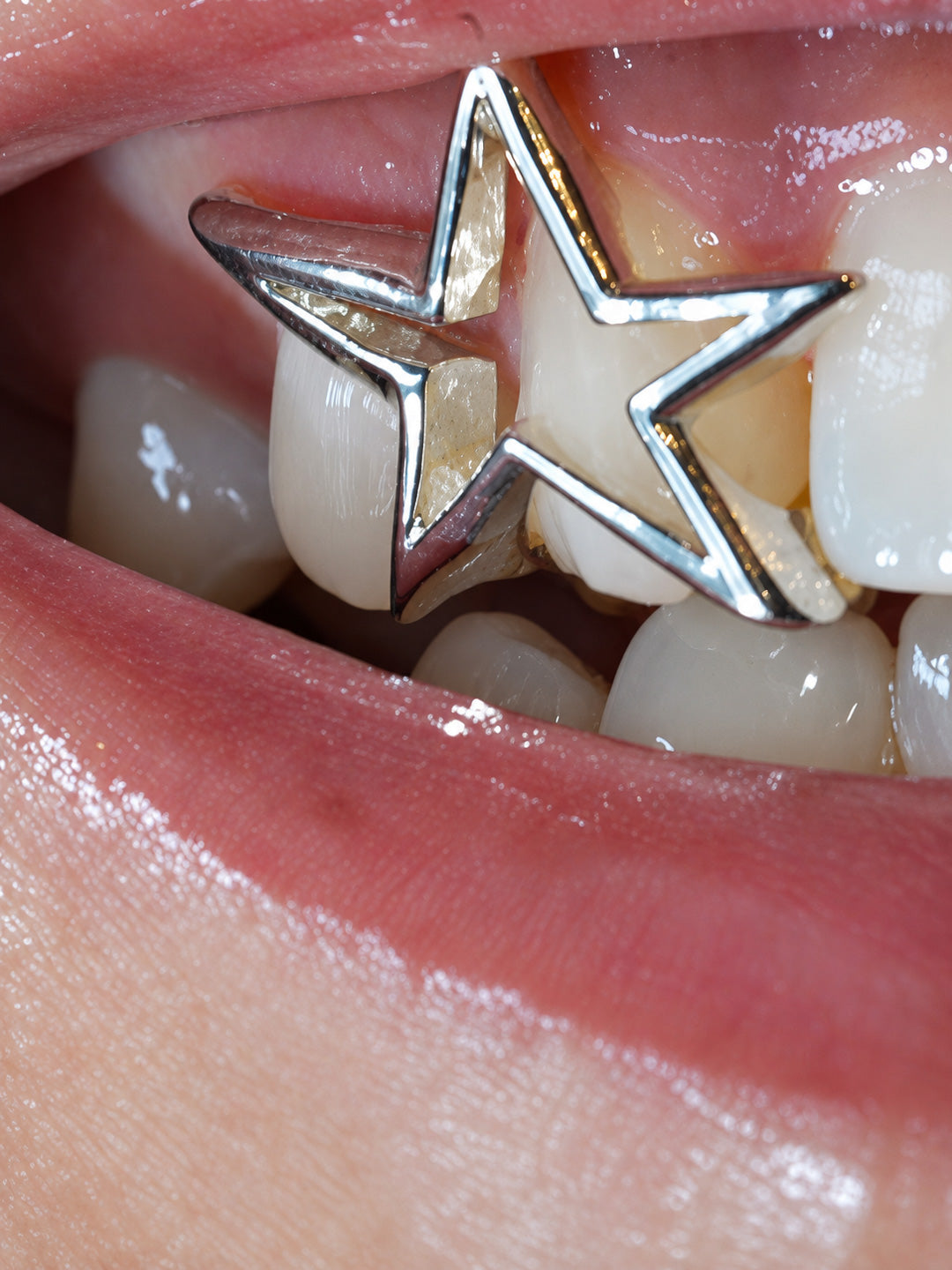 Star window grillz in white gold worn on a single upper tooth, custom cut-out design, bespoke by Illoom Sydney