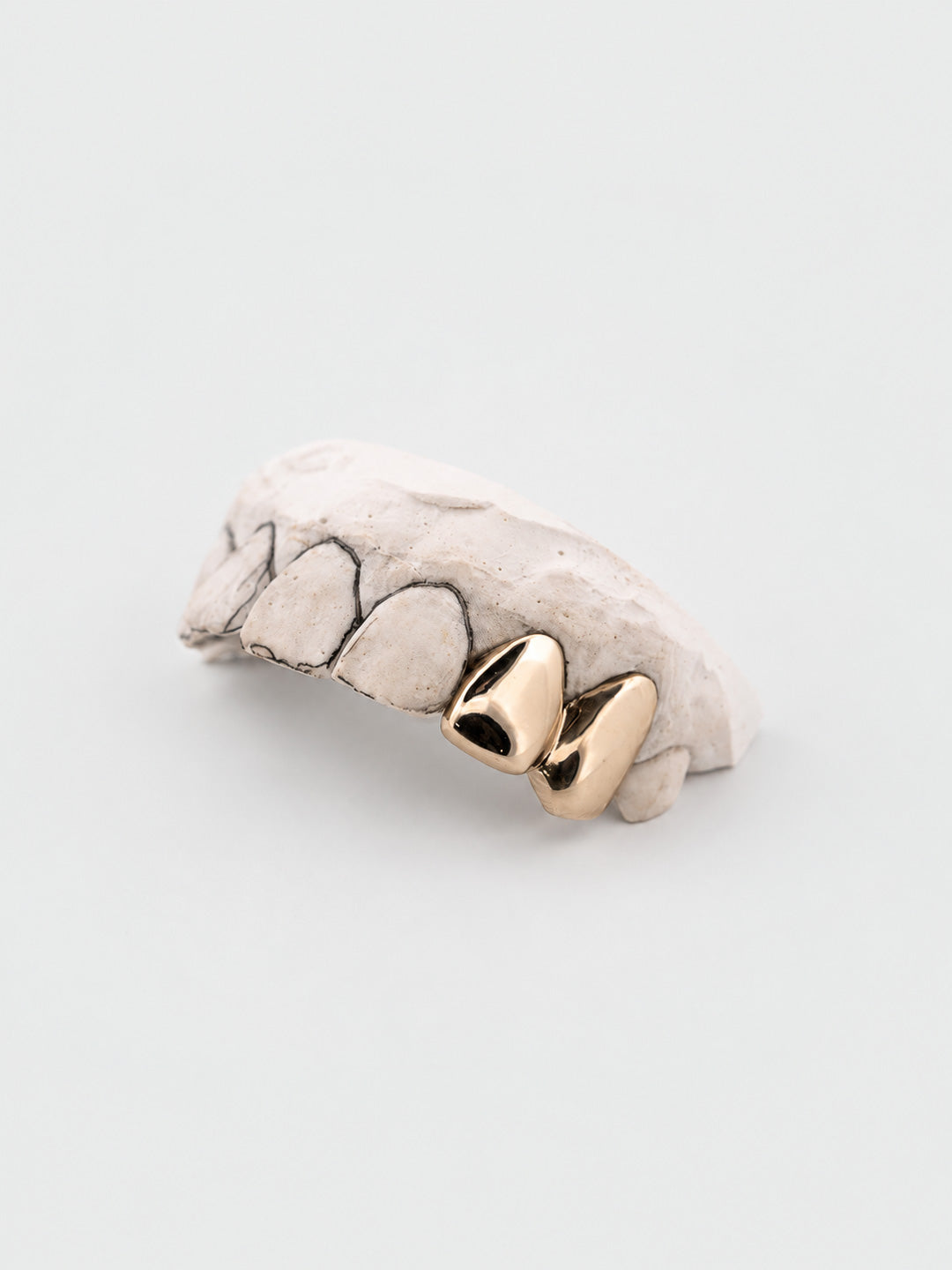 Two tooth grillz in 9k yellow gold, plain polished caps on dental mould