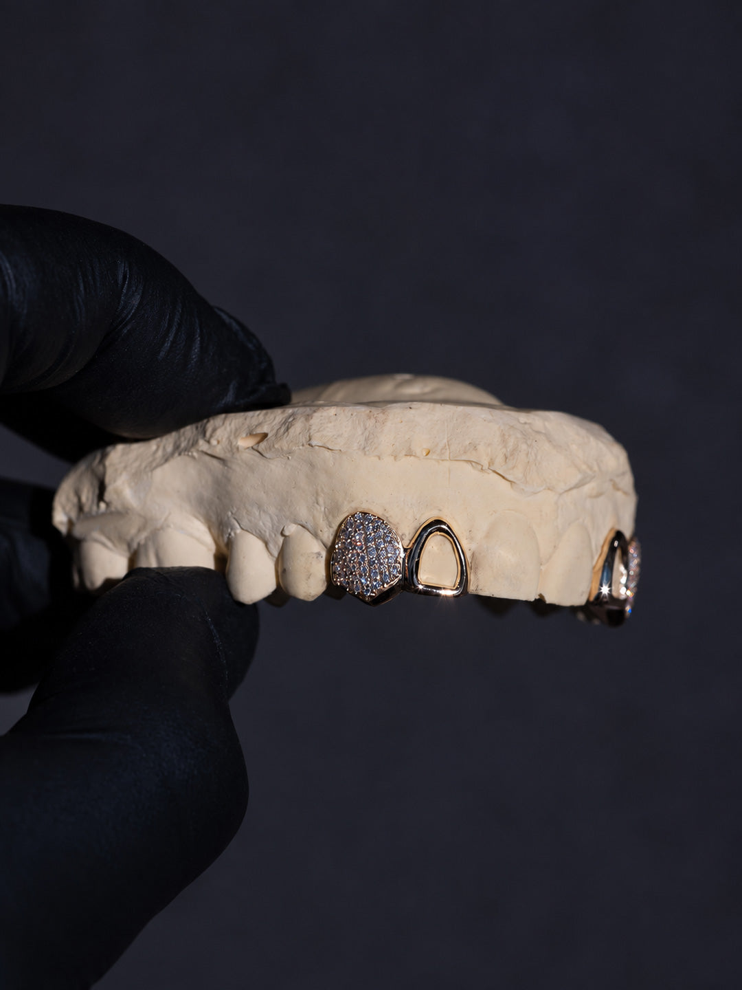 Two tooth grillz in 9k yellow gold, pavé diamond tooth paired with an open face window, bespoke by Illoom Sydney