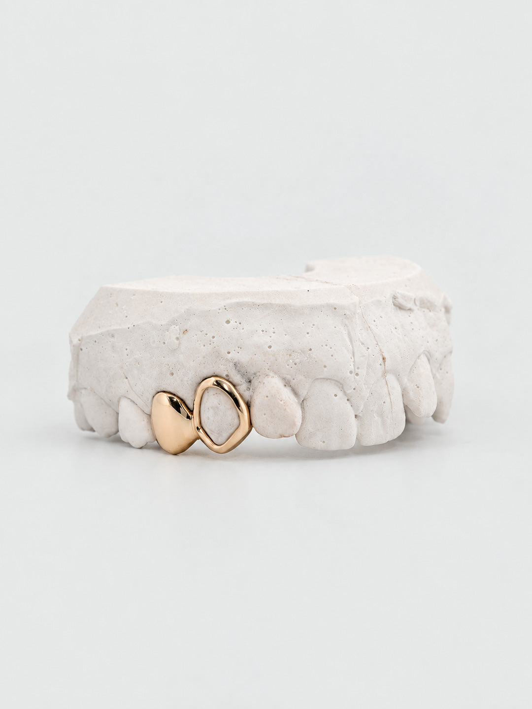 Two tooth grillz in yellow gold, one open face window paired with a plain classic gold tooth, on dental mould