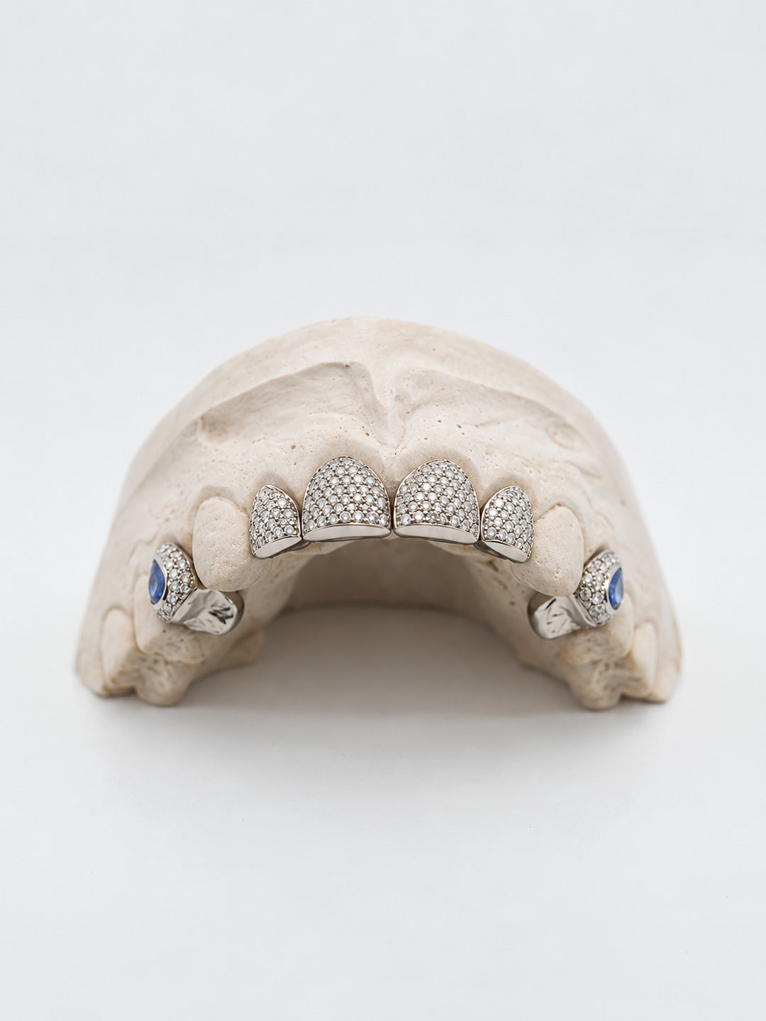 VVS diamond grillz in 18k white gold across four teeth, fully pavé set on dental mould, bespoke by Illoom Sydney