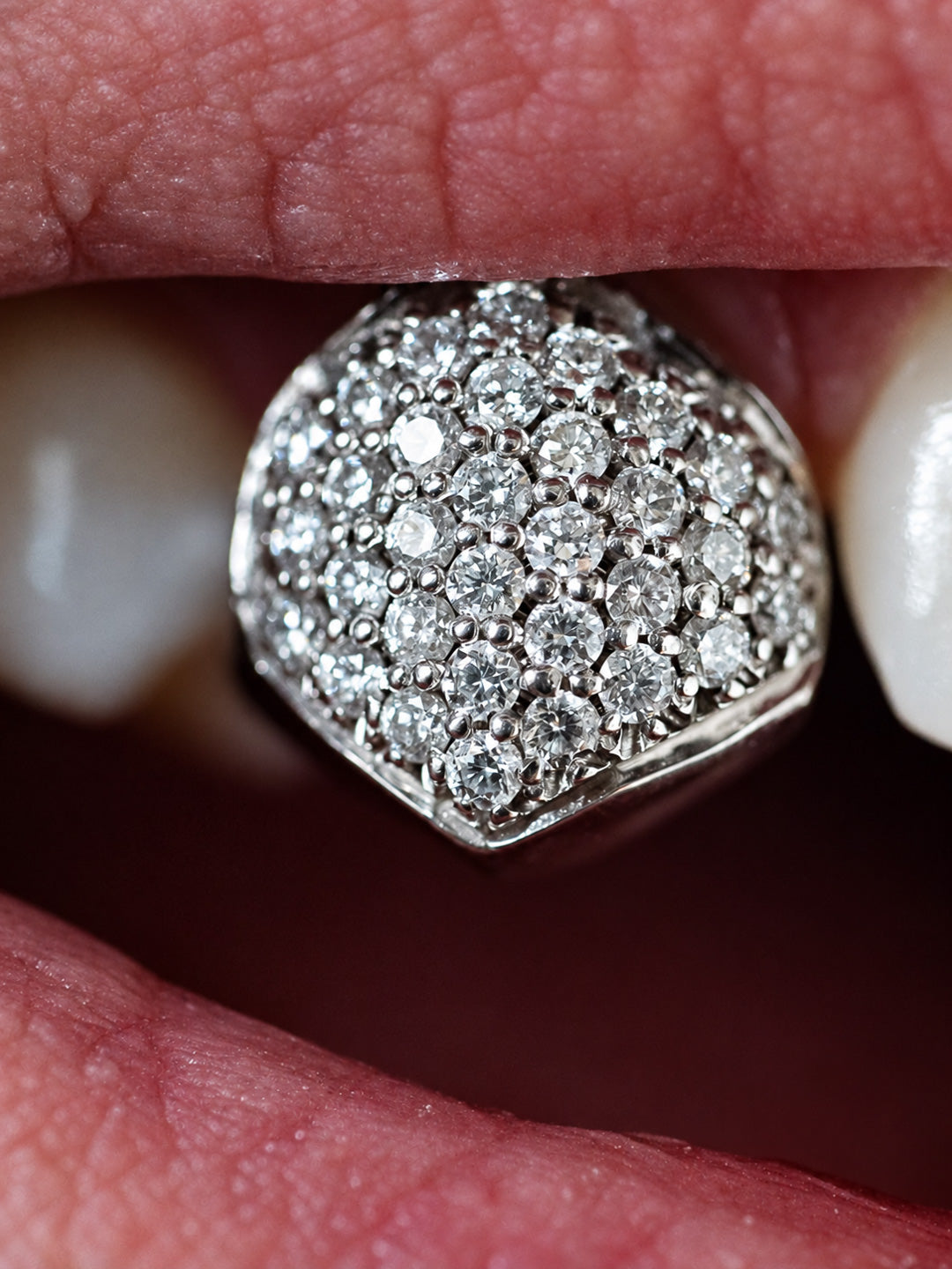 White gold tooth grillz worn on a single upper tooth, pavé set with VVS natural diamonds