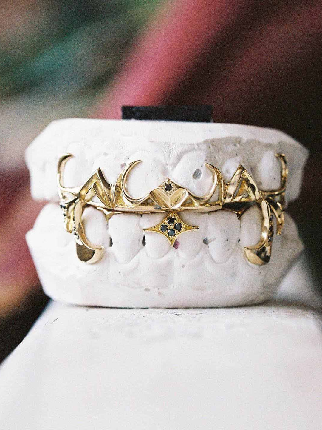 Custom designed grillz in 18k yellow gold set with black diamonds, bespoke by Illoom Sydney